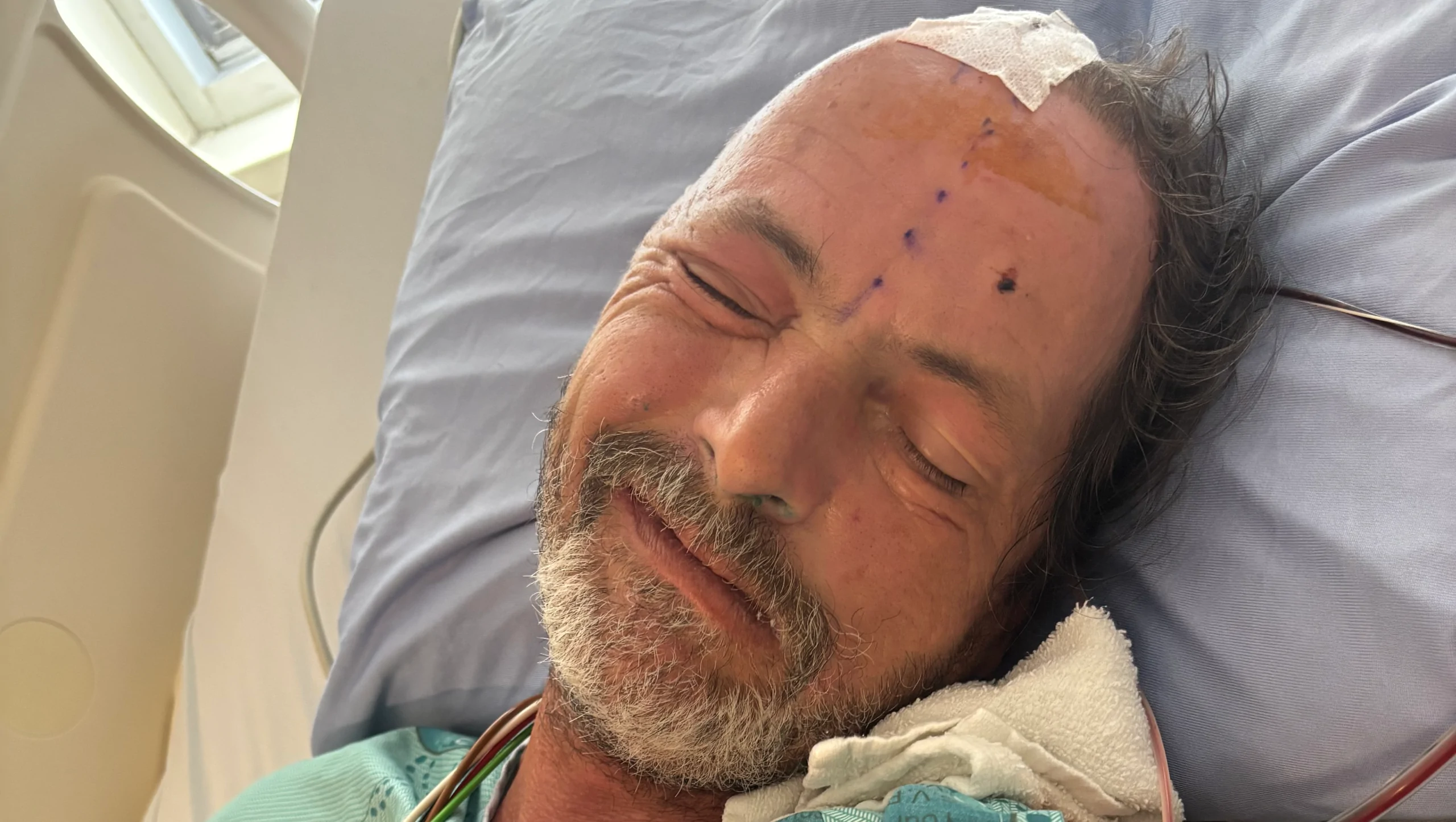 Richard Oliver brain surgery and stroke – GoFundMe Fundraiser gofundme Donation Help