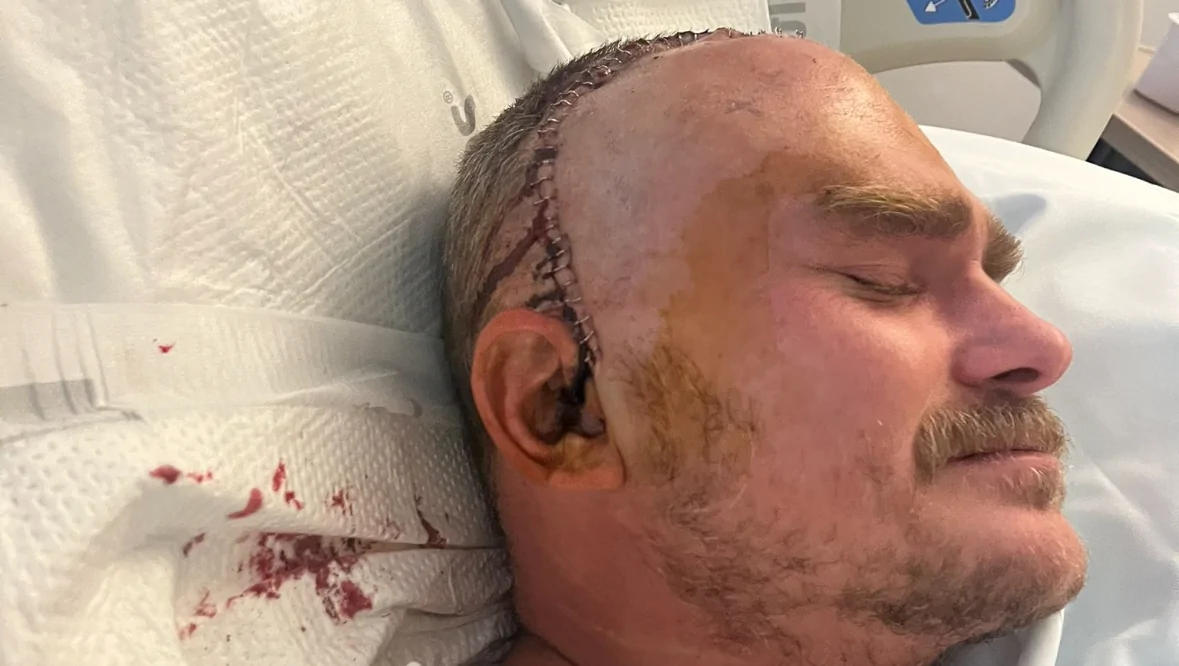 Help Matthew in His Glioblastoma Journey – GoFundMe Fundraiser gofundme Donation Help