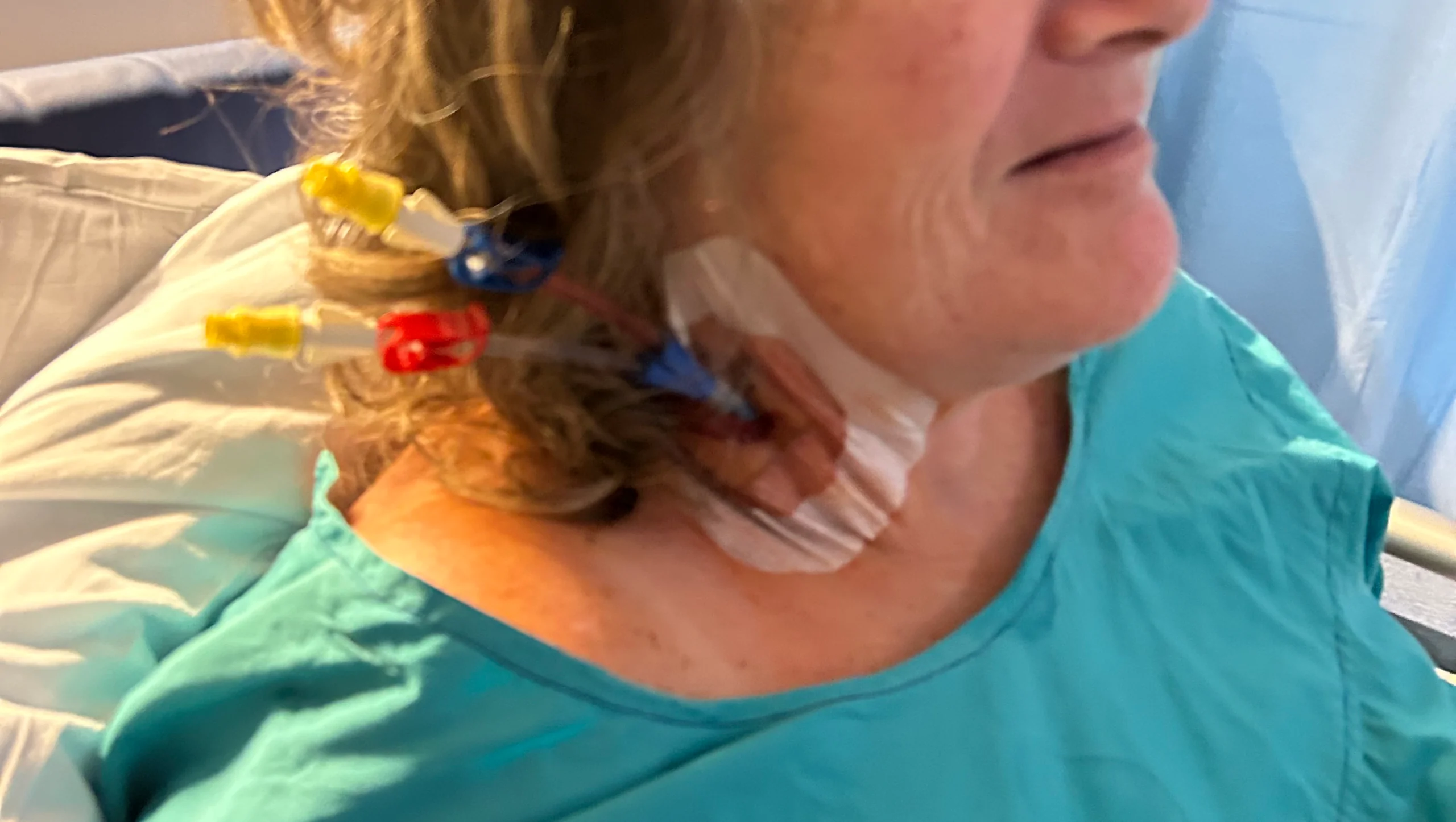 Kylie battle MS and aphasia – GoFundMe Fundraiser gofundme Donation Help